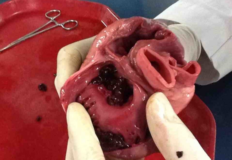Ученые напечатали живое сердце на 3D-принтере